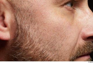 HD Face Skin Neeo bearded cheek face skin pores skin…